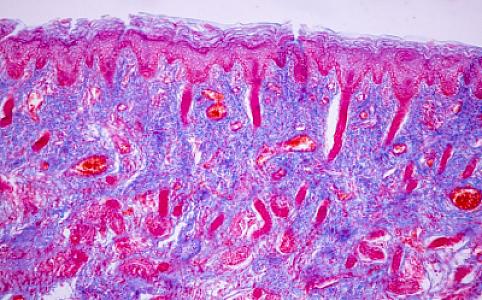 Nadir immun çatışmazlığı olan uşaqların