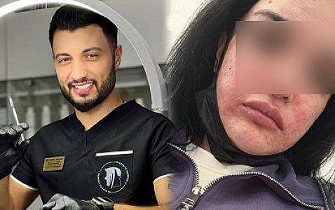 “Prosedurdan sonra mənə dedilər ki, o həkim yox, bərbərdir”