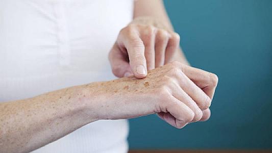 Əllərdə ləkələrin yaranmasına səbəb nədir? -