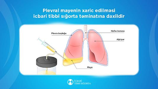Ağciyərlərə yığılmış mayenin çəkilməsi məqsədilə