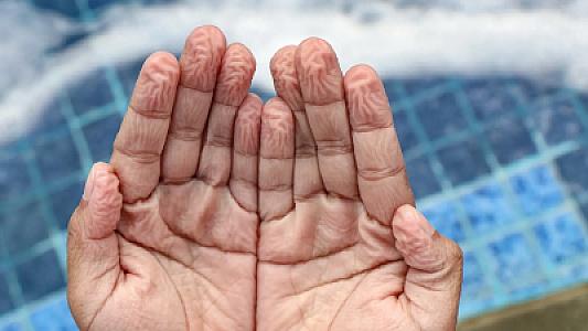 Barmaqlar suda niyə qırışır? -