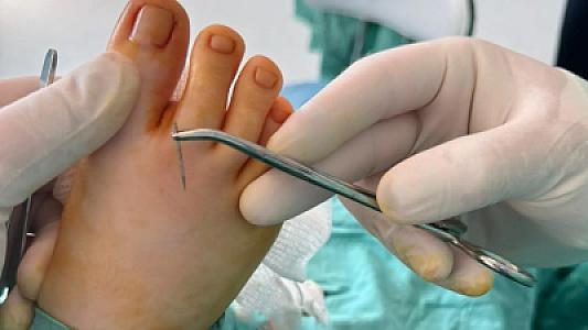 11 yaşlı uşağın ayağında qırılıb qalan iynə