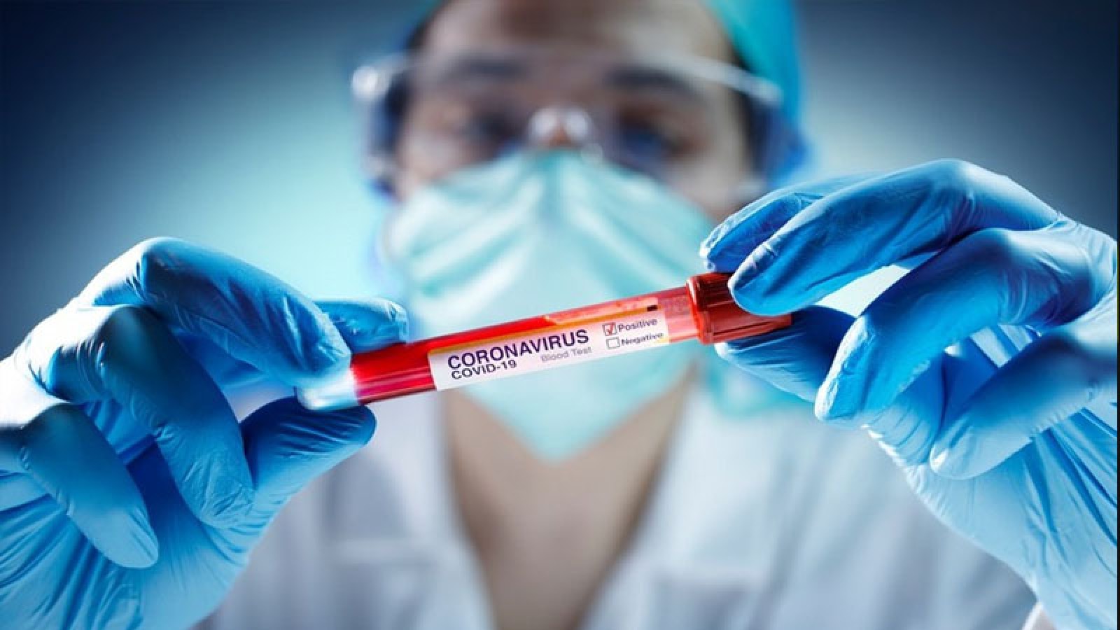 Bakıda koronavirus yayılıb? -