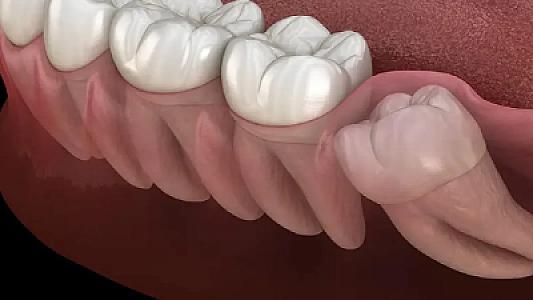 Ağıl dişi olanlara sevindirici xəbər: