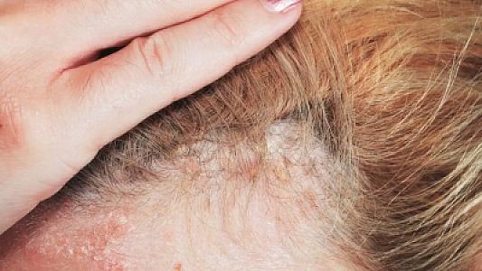 Əlamətlərə məhəl qoymadı,