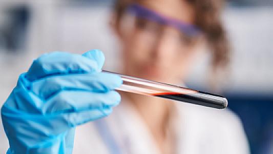 Bu yolla erkən doğuşu