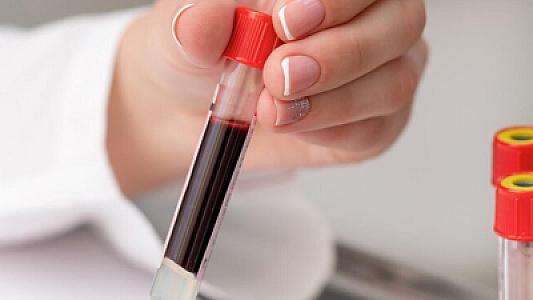 Alimlər süni qan qrupu