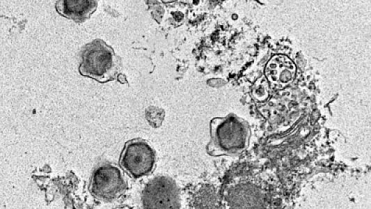 Okeanda tapılan 230 yeni nəhəng virus insan sağlamlığına təsir edə bilər -