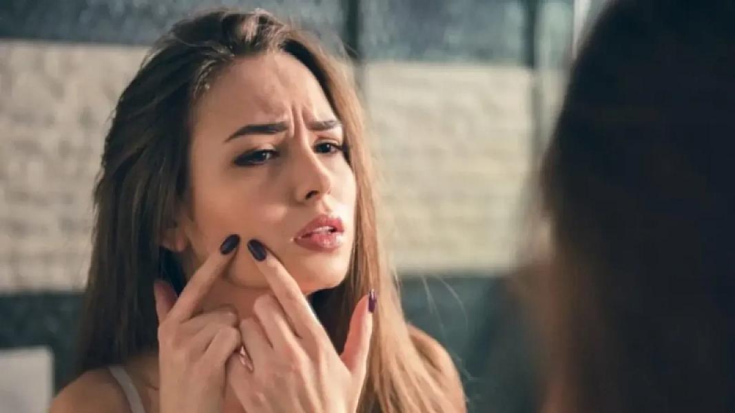 Dermatoloqlardan xəbərdarlıq: