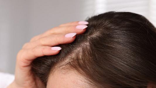 Qadınlarda doğuşdan sonra saç tökülməsinin