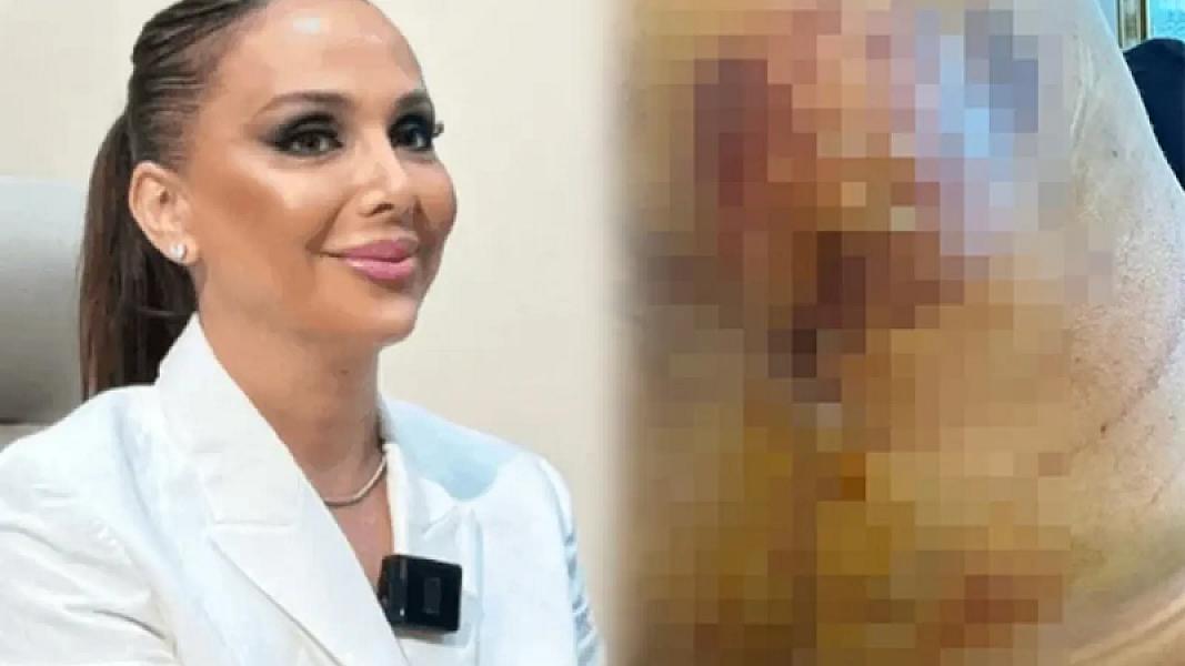 Məşhur plastik cərrahdan şikayət: