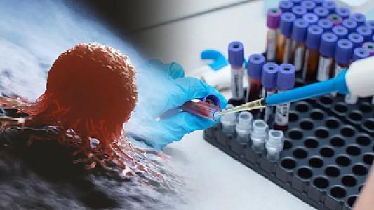 Alimlərdən yeni araşdırma! Xərçəngin diaqnozu qoyulmadan