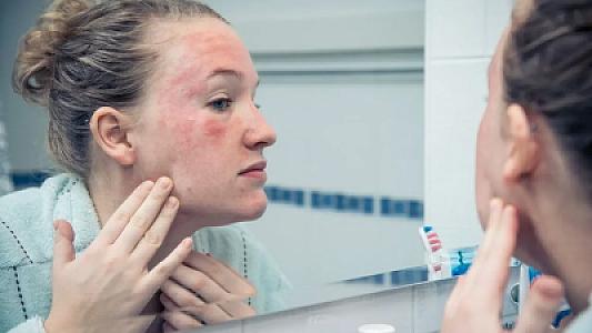 Xəstə bağırsaqların