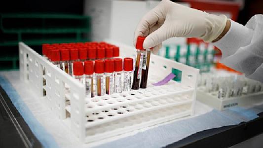 Bu halda xolesterol səviyyəsini aşağı salmamaq faydalıdır -