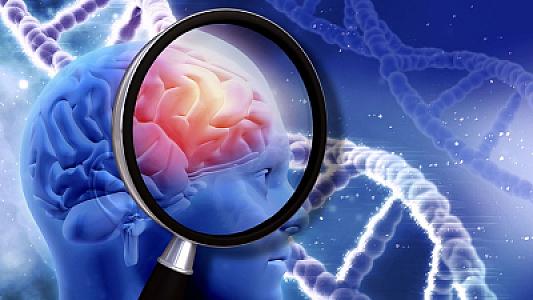 Dünyanın ən gənc Alzheimer xəstəsi: