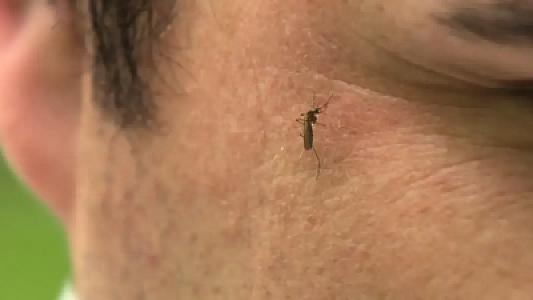 Alnından 15 sm-lik qurd çıxarıldı: