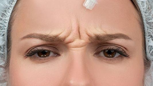 Alimlər Botoksun gözlənilməz