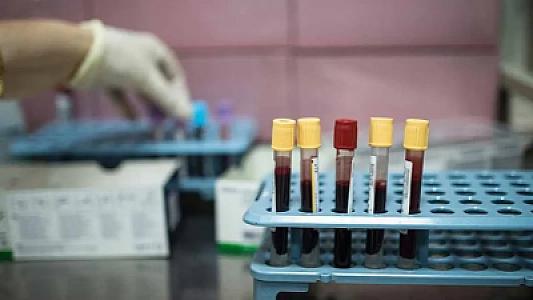 Xərçəngin bu növü Y nəslinin