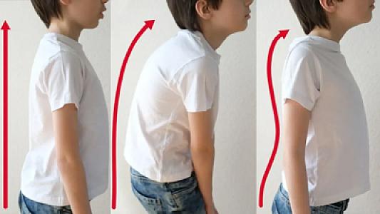 Uşağınızın duruşuna diqqət yetirmisinizmi? Bu problem qalıcı fəsadlara yol aça bilər