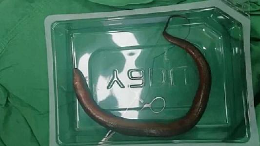 Qarın ağrısı ilə xəstəxanaya getdi -