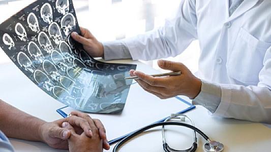 Qulağındakı cingilti beyin xərçənginin xəbərçisi oldu -