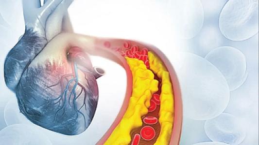 Xolesterol düşündüyünüz qədər sadə deyil:
