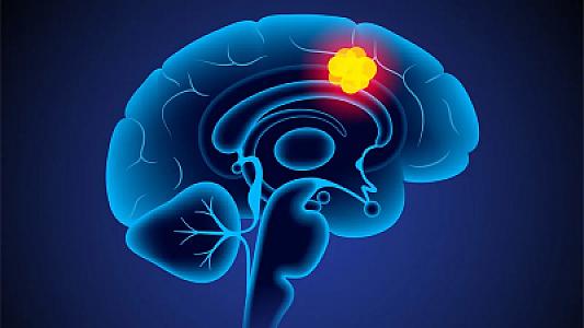 Bu müalicə sayəsində ölümcül xərçəngdən