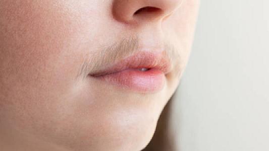 Həkim qadınlarda bığın səbəblərini izah etdi: