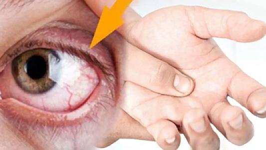 Əl, göz və ayaqdakı səyirmələrə təsirli təbii həll: