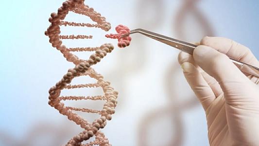 Yaponiyada həkimlər ilk dəfə Daun sindromlu xəstədən