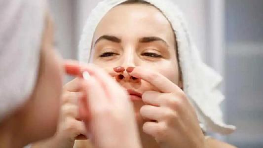 Çənədəki qara nöqtələr üçün