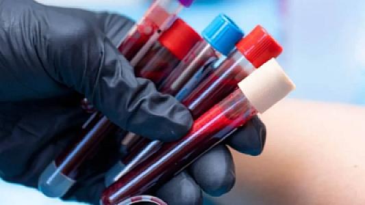 Tibb tarixində böyük kəşf: