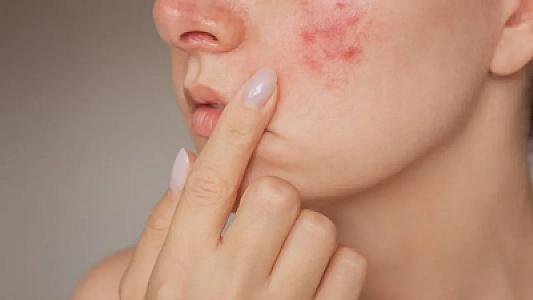 Harvard mütəxəssisi izah edir: