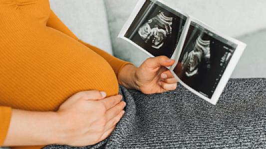 Süni mayalanmanı bu ayda etdirənlər