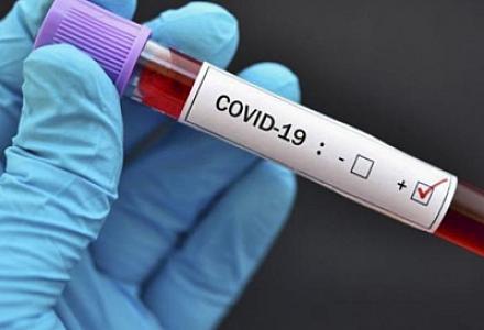 Son sutkada Azərbaycanda 21 nəfər koronavirusa yoluxub, 1 nəfər ölüb