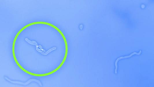 Gözlərinizdə uçuşan cisimləri gördükdə