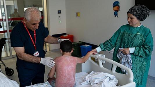 Uşaq günəş altında 4 saat qaldı,