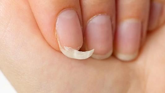 Dırnaqlarınızı yoxlayın: gizli ürək və qaraciyər