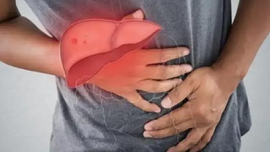 Həkim qaraciyəri spirt kimi dağıdan