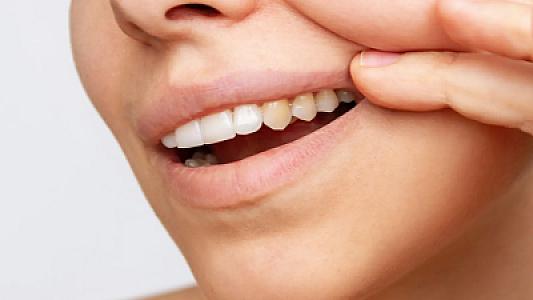 Dişlərdəki sarı ləkələr hansı xəstəliyin