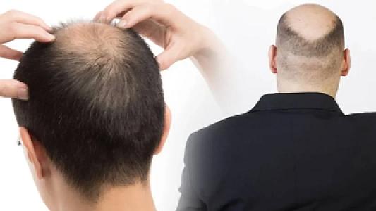 Bu içki başda bir tük də