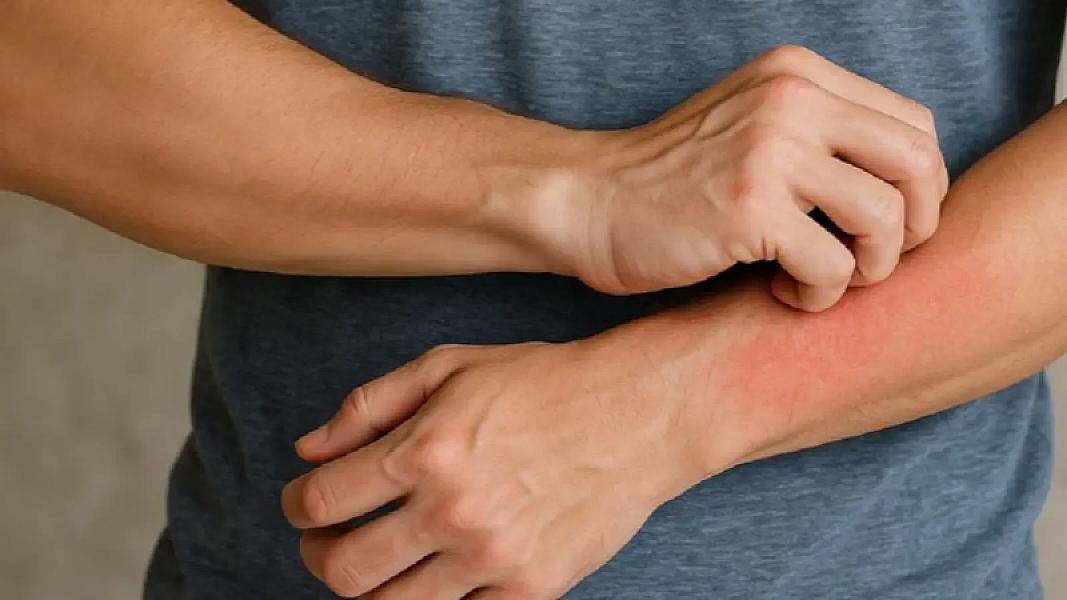 Durduq yerdə bədənin qaşınması