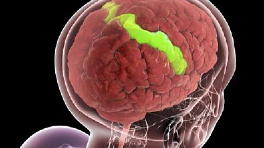 Yaşlandıqca beynin bəzi təbəqələri