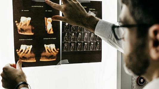 Alzheimer xəstəliyinin səbəbi