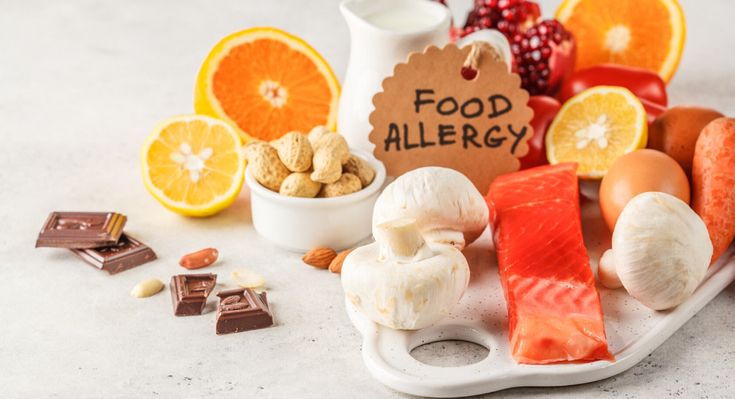 Qida allergiyası genetik ola bilərmi?