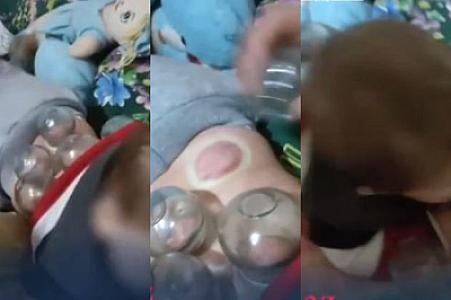 7 aylıq uşağın belinə banka qoydular - Sağlamlığına hansı fəsadlar yarana bilər? -