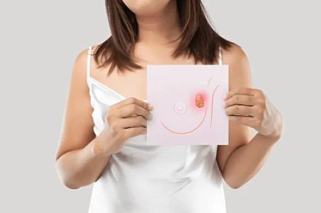 Döş xərçəngi və irsi riskləri - 