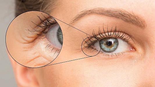 Göz ətrafındakı qırışlara qarşı 