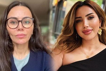 Qənirə Ataş saxta kosmetoloqa