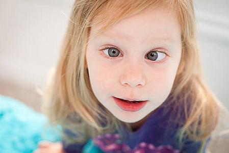 Çəpgözlük - Səbəbləri və 